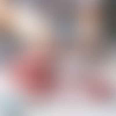 From Denture Fit to Maintenance: The Role of Denture Liners